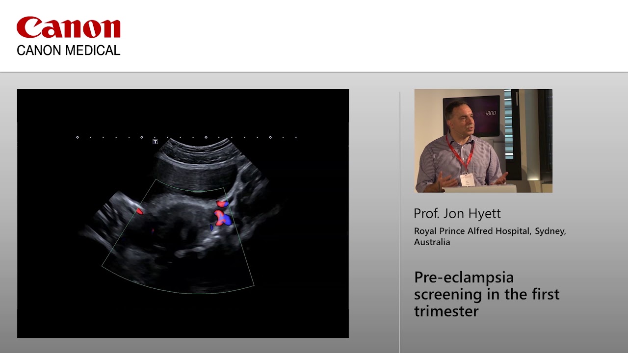 Professor Jon Hyett Preeclampsia screening in the first trimester