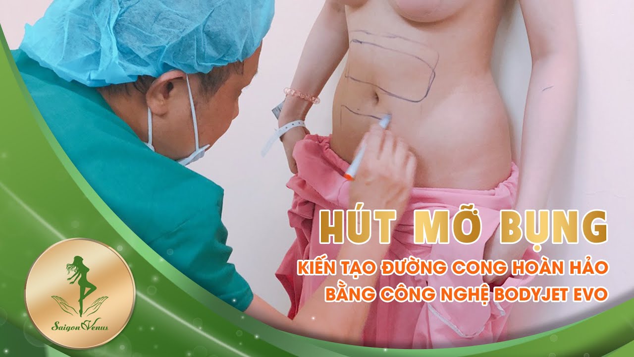 Hút mỡ bụng công nghệ Body Jet Evo mới nhất hiện nay - Thẩm mỹ viện Sài gòn venus - YouTube