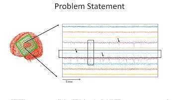EEG-GRAPH NIPS Video Presentation