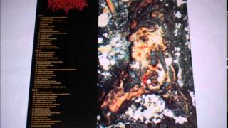 Regurgitate - Confluent Macular Drug Eruption (HQ)