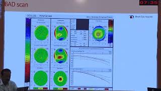 AIOC2026   IC260   T Dr Bhupesh Singh Corneal Refractive Surgery   Spectrum  Indications and Conside