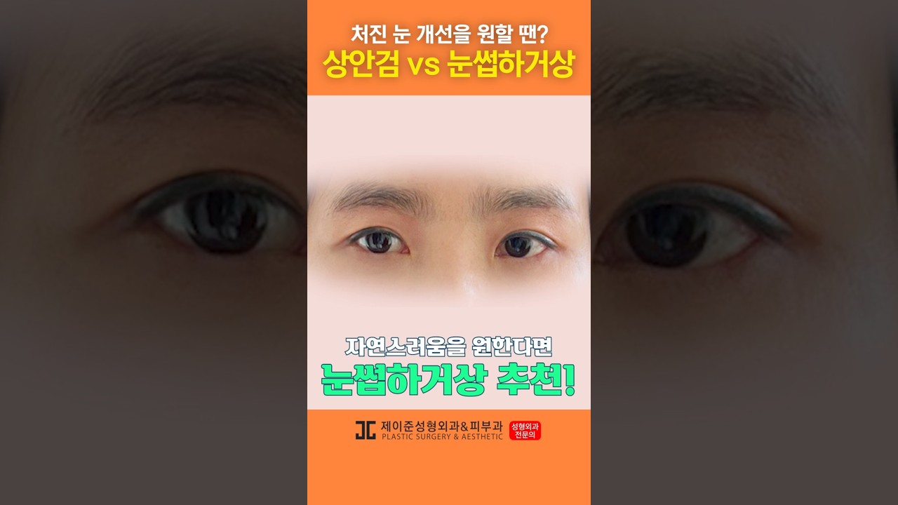 [Thẩm mỹ viện Jayjun] Giải quyết tình trạng sụp mí mắt? Hãy biết điều này trước khi quyết định phẫu thuật! #shorts