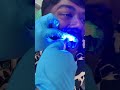 ✨Clear Aligners se pao perfect smile – comfortable & invisible!