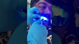 ✨Clear Aligners se pao perfect smile – comfortable &amp; invisible!