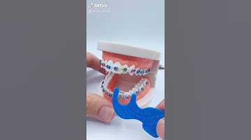 How to floss with Braces!