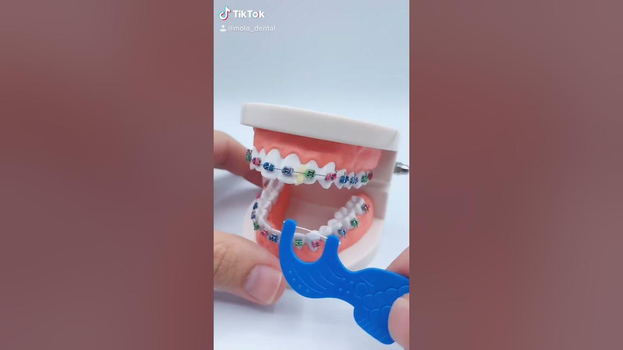 How to floss with Braces! YouTube