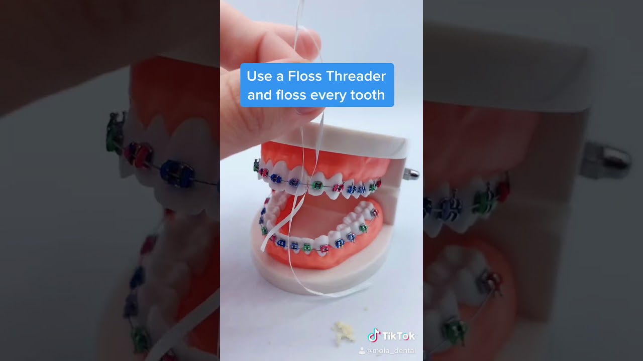 How to floss with Braces! YouTube