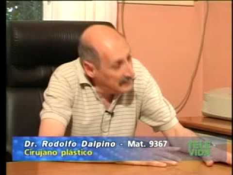 medicos especializados internacionales Dr. Rodolfo Dalpino - Adiposidad localizada