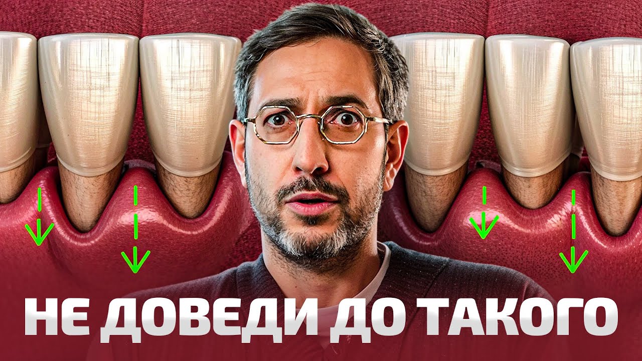 Начала уменьшаться десна, что делать? Лечение рецессии десны