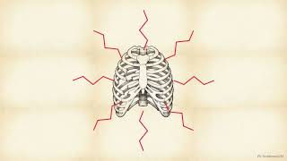 RibCageImp: A Deep Learning Framework for 3D Ribcage Implant Generation