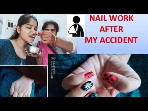 NAIL ART AFTER My ACCIDENT||LOCKDOWN ACCIDENT|| slip fall accident ...