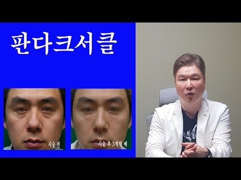 눈밑색조, 굴곡교정을 영구적으로 제거하고 싶으시면 판다크서클