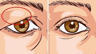 Wie wird die Haut unter den Augen dicker?