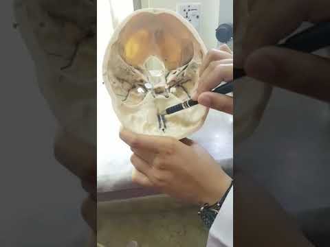 Skull Interior View 2nd Year Guide Youtube