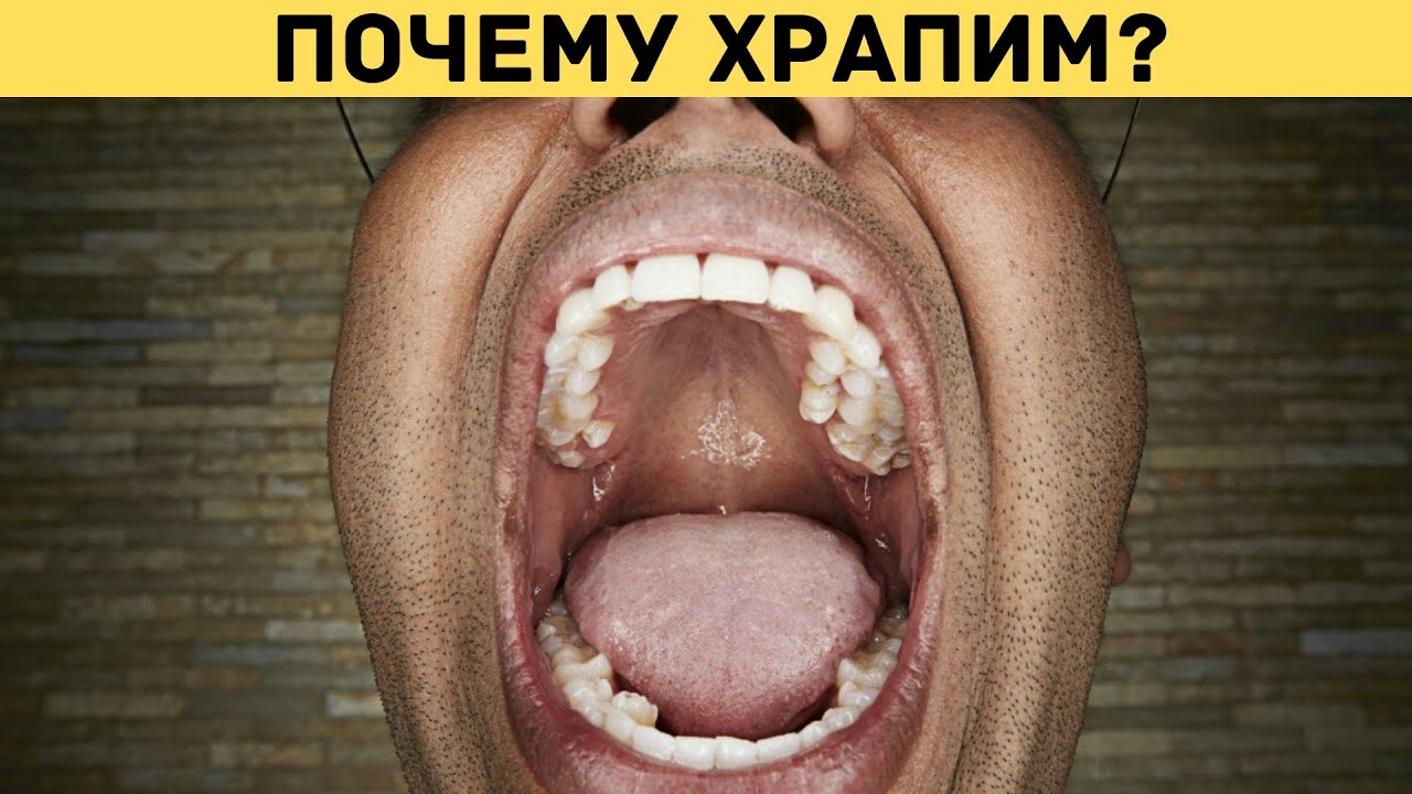 Почему человек храпит и можно ли избавиться от храпа? - YouTube