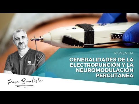 Generalidades de la Electropunción  y la Neuromodulación Percutanea