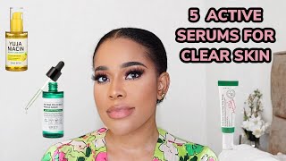 TOP SERUMS FOR CLEAR SKIN. Hyperpigmentation, dark spots, dry skin, acne, blemishes etc.