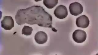 Vücudumuzun mikroplarla savaşı (Bağışıklık sistemi ve önemi)