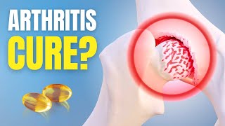 Arthritis? You're Treating It Wrong! See How to Actually Repair Cartilage