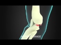 Leatt C-Frame Knee Brace Features Video