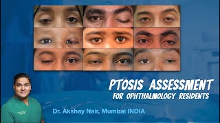 Ptosis Evaluation for Ophthalmology students - Residents and Fellows