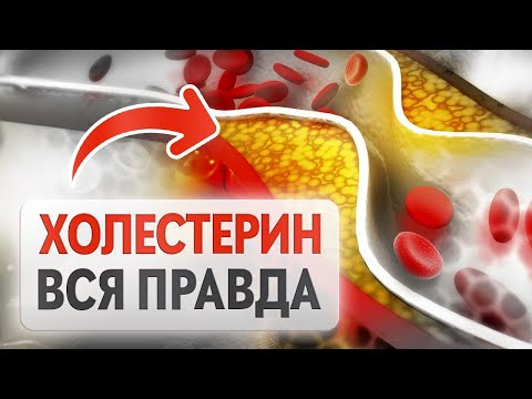 Как ГАРАНТИРОВАННО снизить высокий холестерин? ТОП-4 причин повышения ХОЛЕСТЕРИНА.