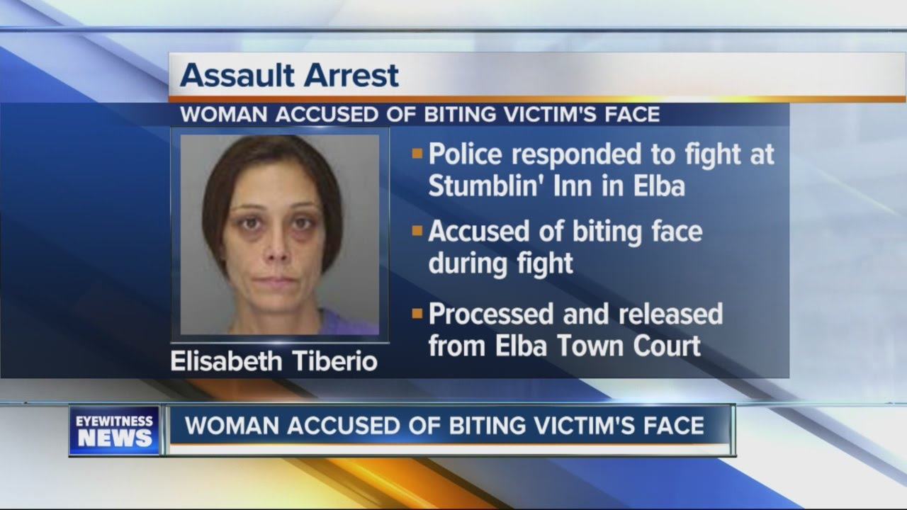 Woman accused of biting victim's face - YouTube