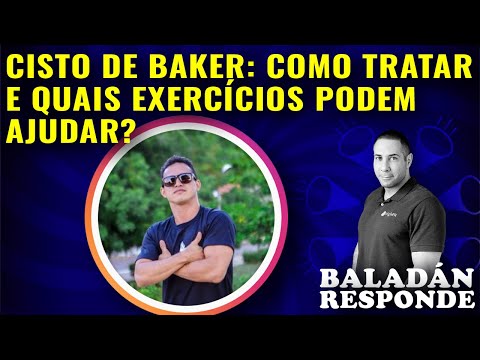 Vídeo: Exercícios De Cisto De Baker: 5 Exercícios Para Ajudar A Gerenciar Um Cisto