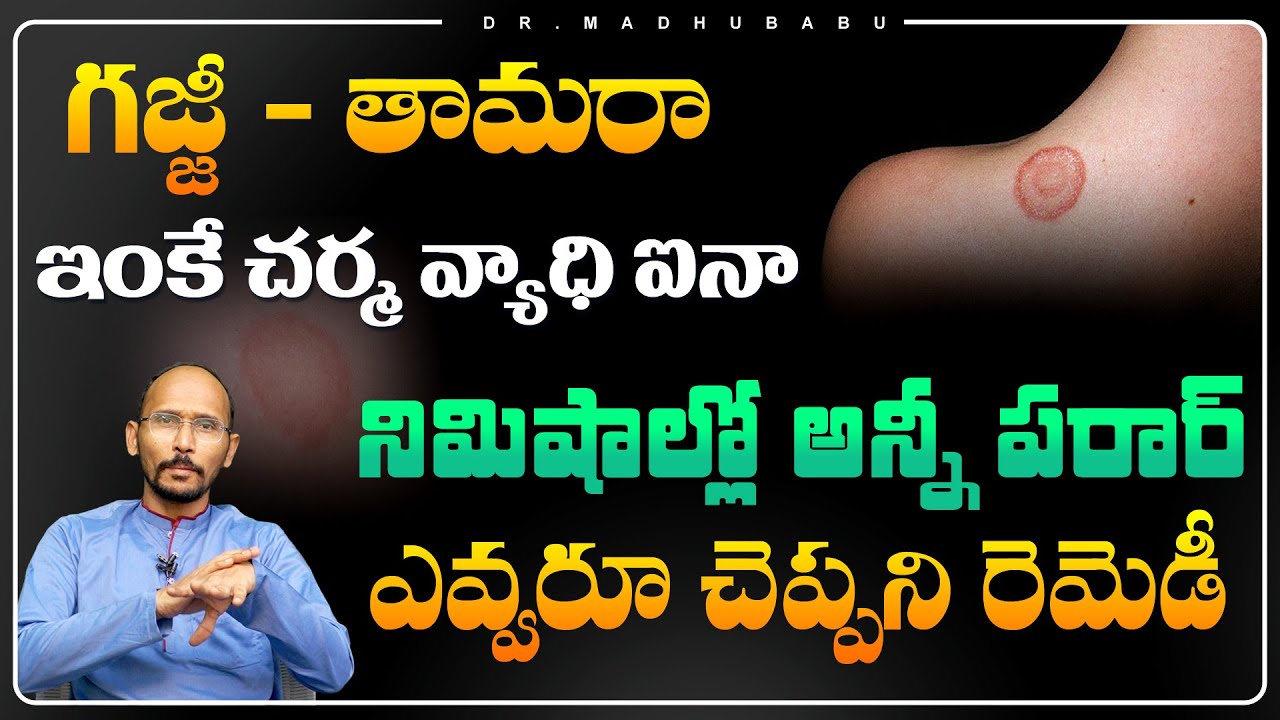 Magical Home Remedy for Skin Diseases in Telugu | SKIN PROBLEMS | Dr. MadhuBabu | Health Trends
