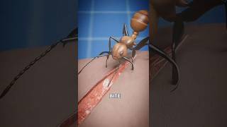 “जब सैनिकों ने चींटी से लगाए टांके 😱 | Ancient Ant Surgery Explained”