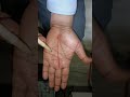 #hastrekhashashtra #palmistry luckline#luckysign #luckyman#भाग रेखा दो मुखी होकर बुध पर्वत पर जाएं