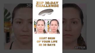 ⚡ZIIP HALO 30-DAY TRANSFORMATION: Unlock your best skin #ziiphalo #microcurrent #beforeandafter