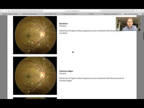 Lecture: How to Use Automated Interpretation for Fundus Images