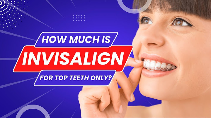 Can you do invisalign on top teeth only