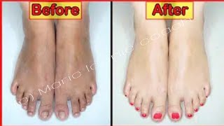 سبا في المنزل: علاج ورعاية القدمين لإعادتها إلى بشرة طبيعية screenshot 5