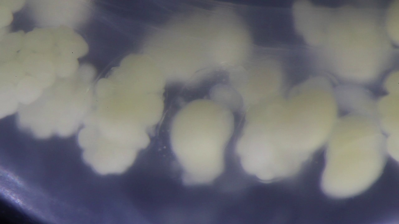 Developing nemertean embryos inside the egg capsule