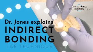 Dr. Jones Explains Indirect Bonding – How it's Made | Jones Family Orthodontics | Monroe, Washington