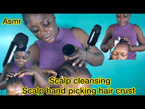 Asmr✨hand picking hair crust, scalp cleansing with wipes, and braids greasing, with gum