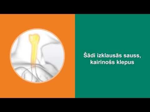 Video: Baltās Gļotas Klepus: Cēloņi Un ārstēšana