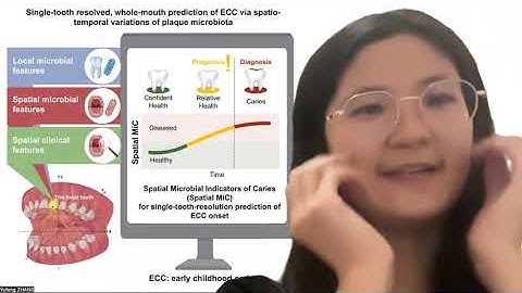 World’s first accurate AI system for single-tooth prediction of early childhood caries detection