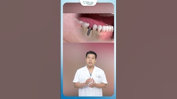 Răng Càng Già Càng Dễ Rụng | Nha Khoa Minh Châu