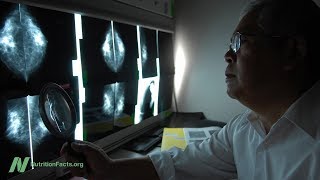 Do Mammograms Save Lives? screenshot 5