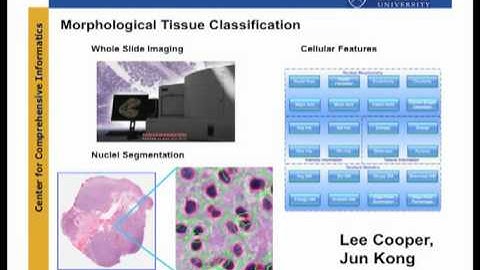 Joel Saltz Discusses Integrative Multi-Scale Approaches to Biomedical Informatics Research