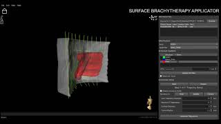 3D Structure Visualization Brachy GIF