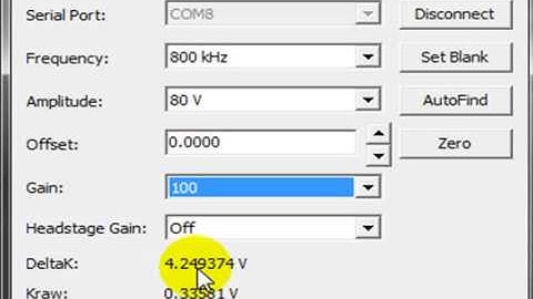 ER125 Detector Software, C4D Contactless Conductivity