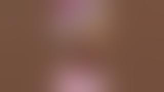 Labia augmentation with Leneva 💉 #plasticsurgery #miamiplasticsurgery #labiaaugmentation