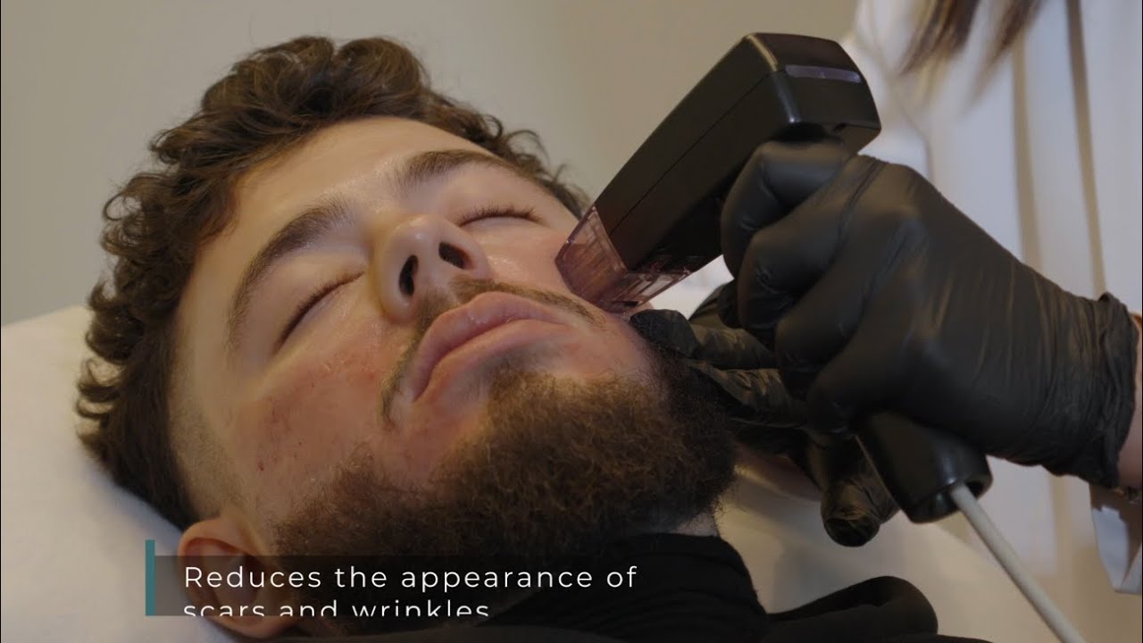 Revitalize Your Skin with Morpheus8 and Exosomes at Seline Clinic