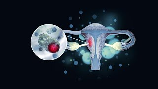 Mayo Clinic Minute - Cervical cancer screening