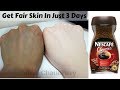 Get Fair Skin In Just 3 Days | Remove Sun Tan From Face & Body | Skin Whitening Home Remedies