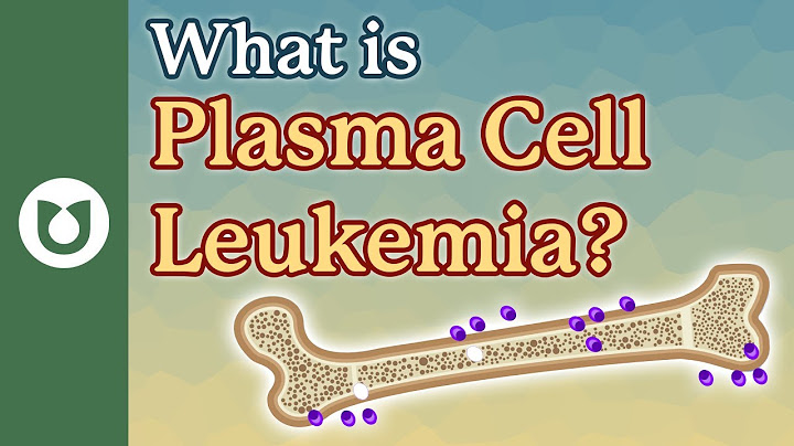 Bone marrow infiltration by plasma cells là gì năm 2024